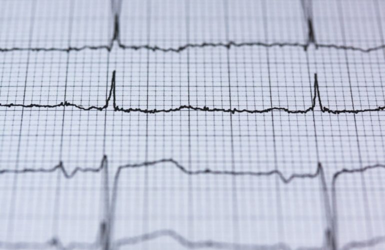 IRC WEB Services pexels-pixabay-415779-770x500 Post Status Notes #488 pexels-pixabay-415779-770x500 Post Status Notes #488 design tips